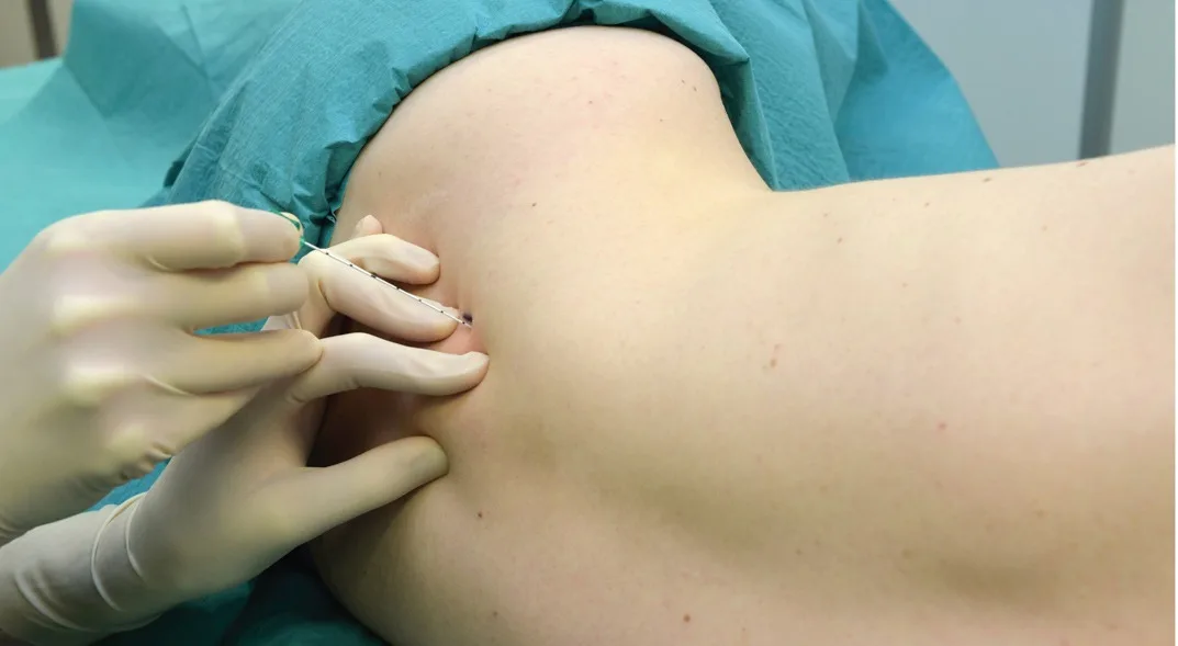 блокада поясничного отдела позвоночника 