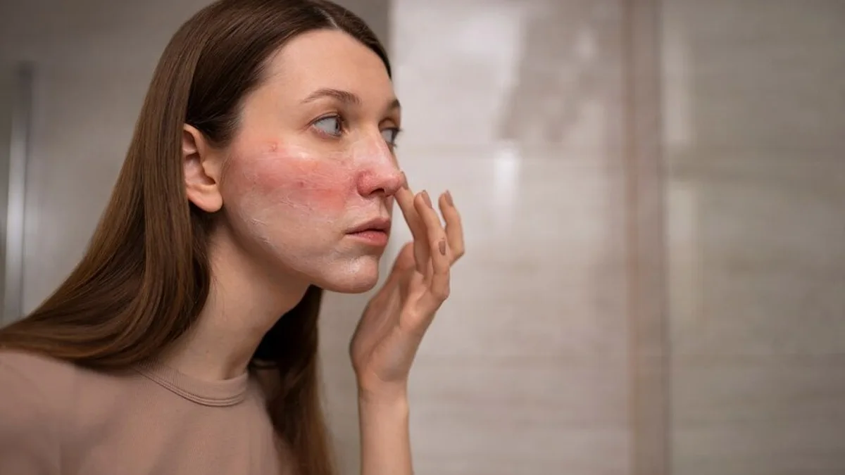 Як зменшити висипання без пересушування: базова рутина догляду, активи за чітким графіком та помилки, через які запалення з’являються знову.